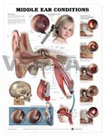 Middle Ear Conditions Anatomical Chart